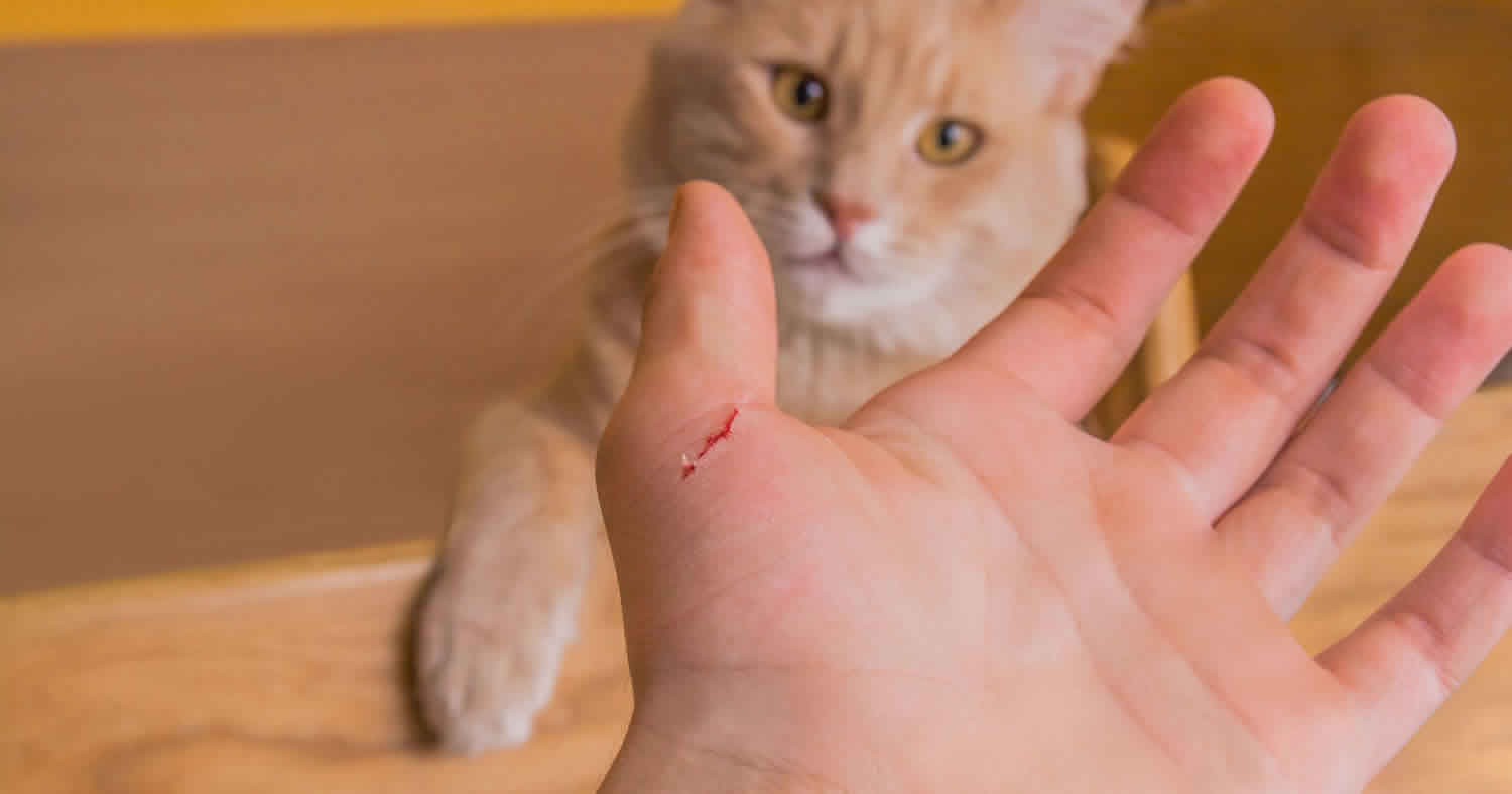 cat scratch disease