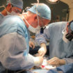 kidney transplant