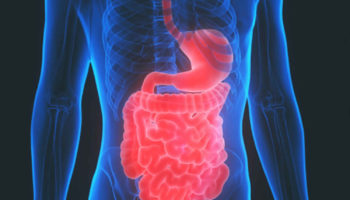 malabsorption syndrome