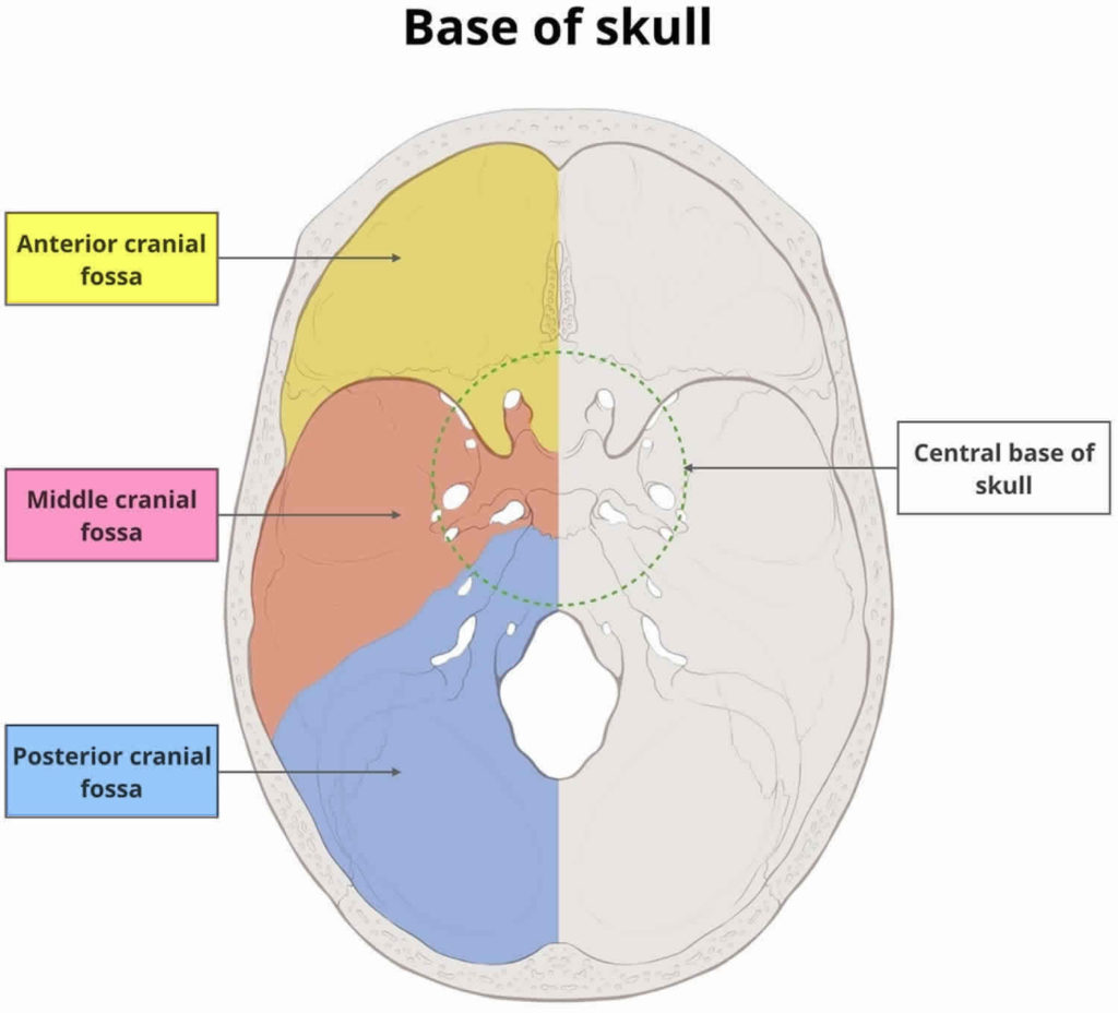 Arachnoid Cyst Causes Symptoms Diagnosis Prognosis And Treatment