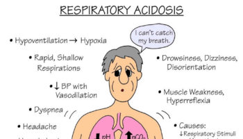 respiratory acidosis
