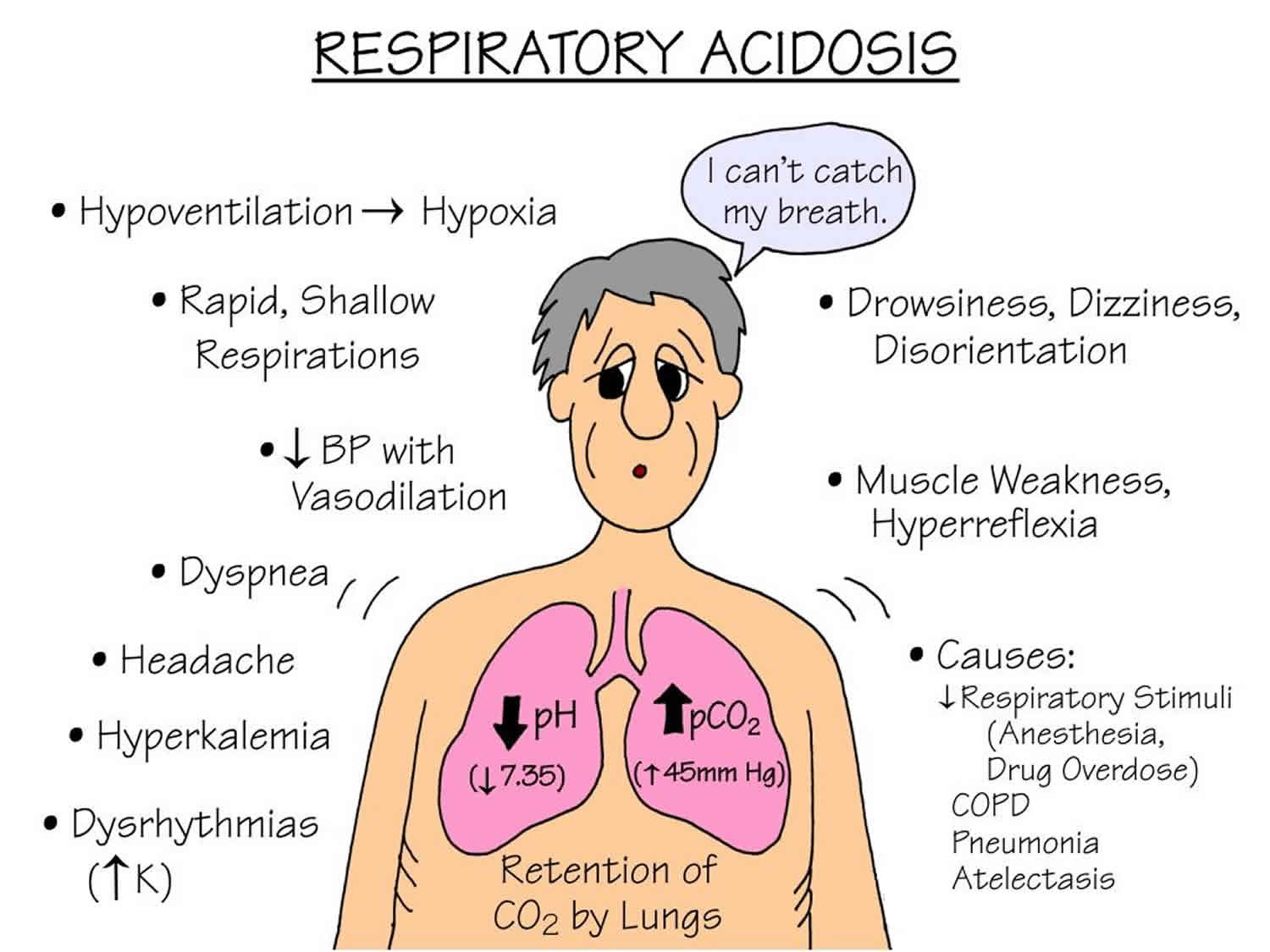 Respiratory acidosis causes, symptoms, signs, lab values and treatment