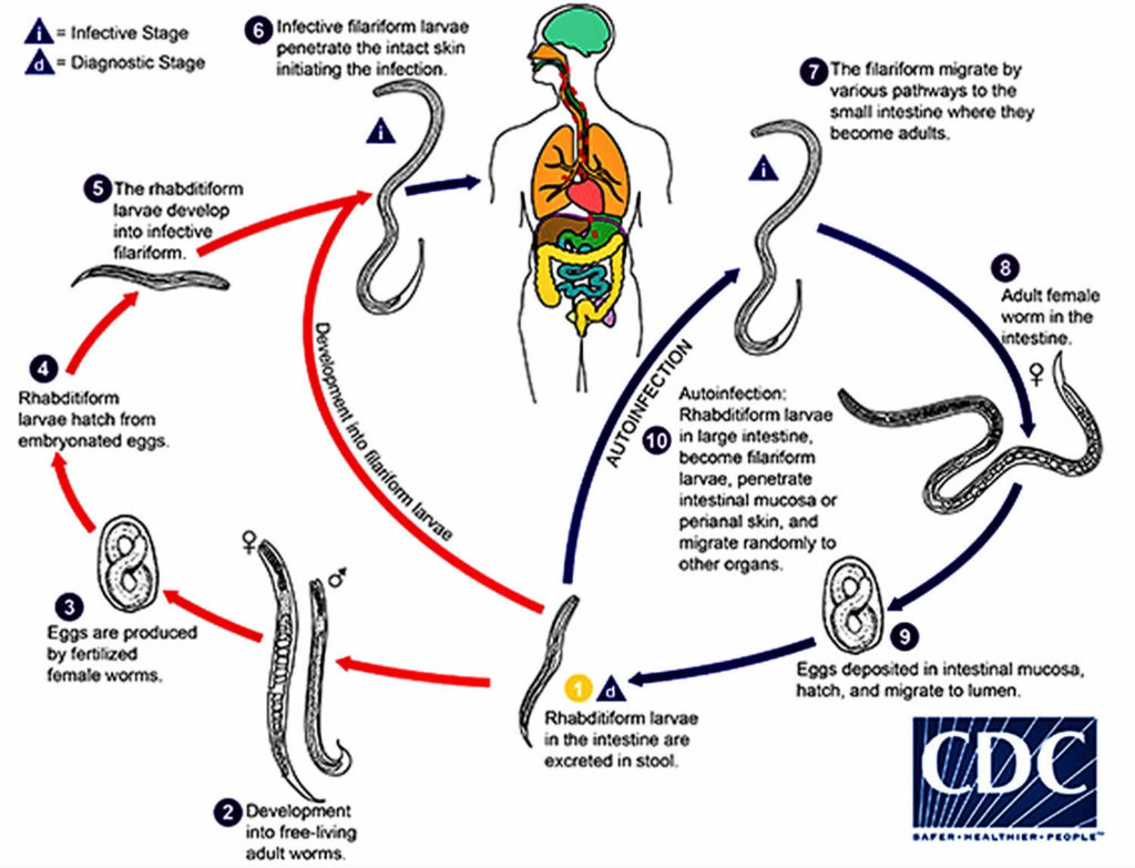 strongyloides-parasite-symptoms-diagnosis-strongyloides-treatment