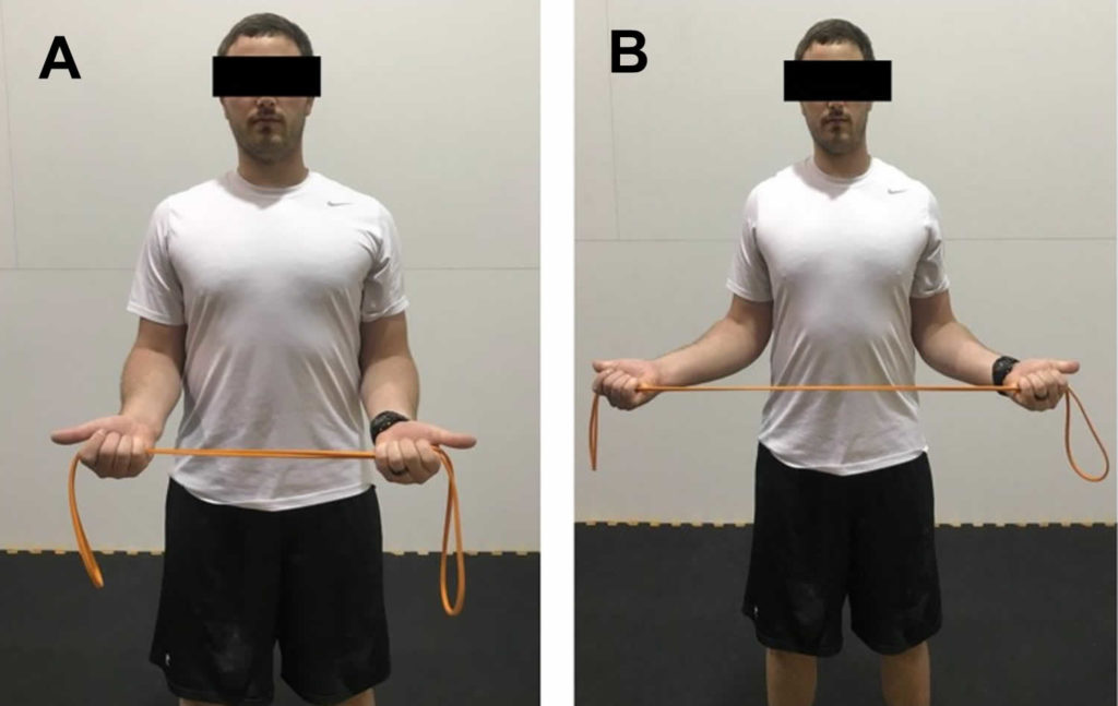 Thoracic outlet syndrome causes, symptoms, diagnosis, exercise & treatment