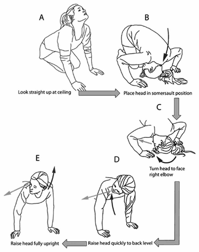 Epley maneuver instructions how to do the Epley maneuver at home