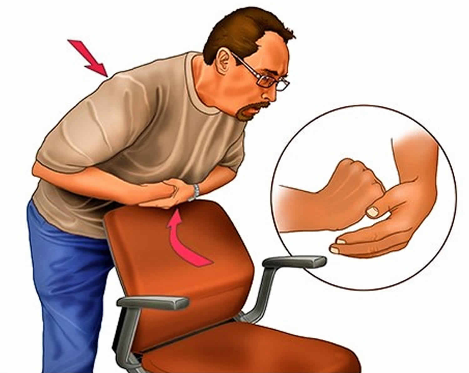 heimlich-maneuver-how-to-perform-the-heimlich-maneuver