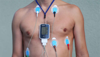 Holter monitor