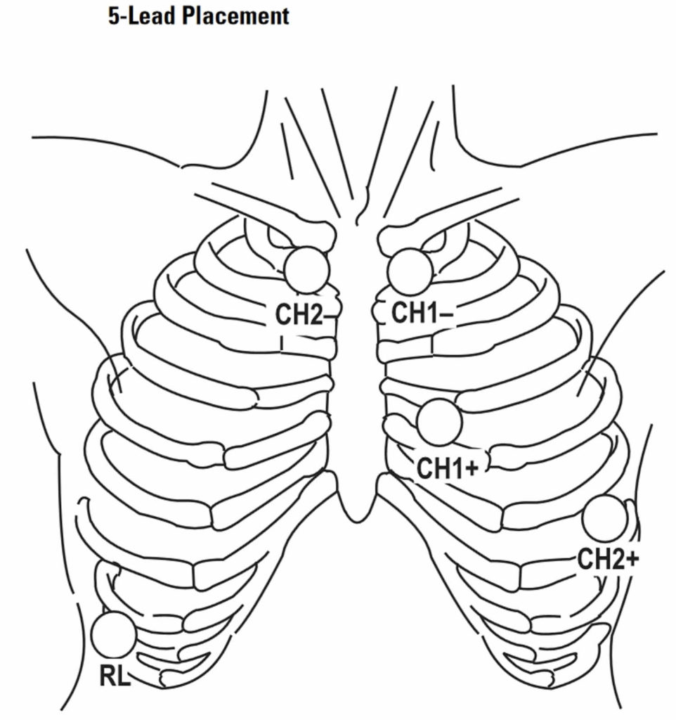 Holter monitor uses, instructions, preparations and Holter monitor results