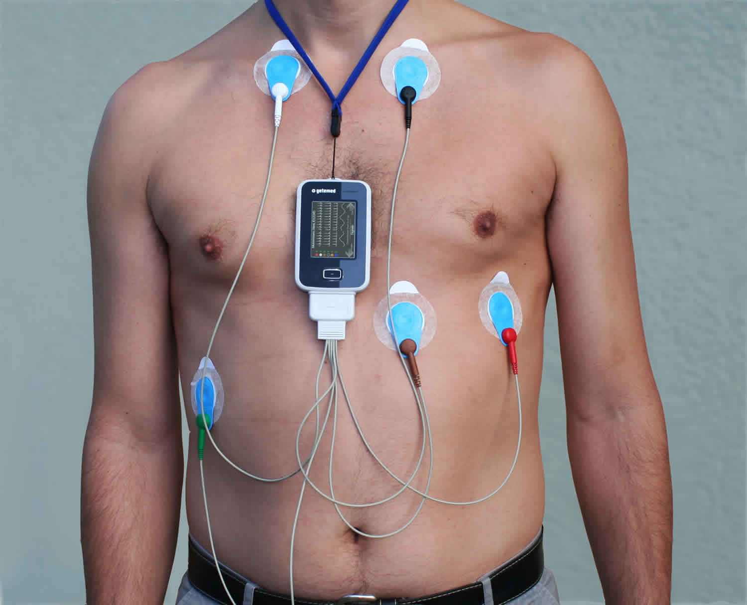 holter test for heart - how to check for heart blockage