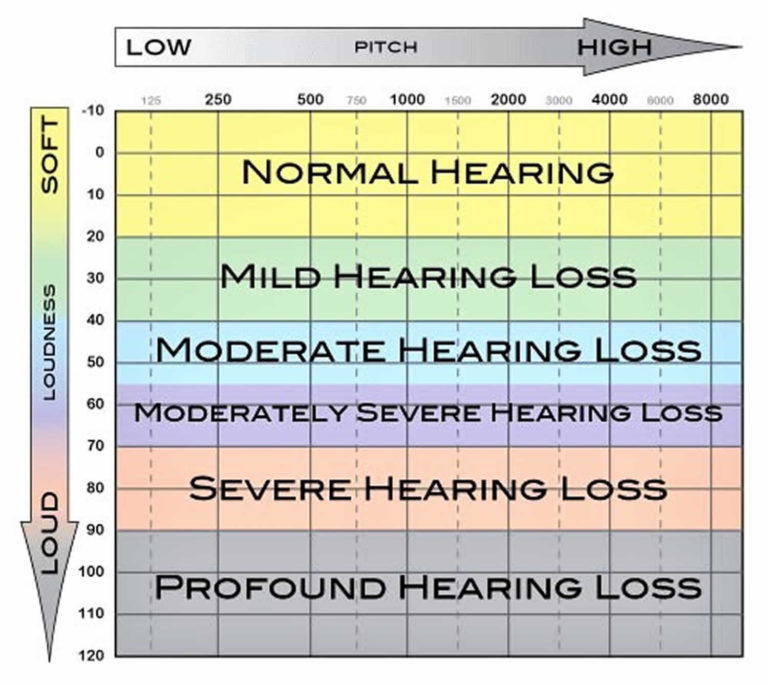 speech recognition test hearing loss