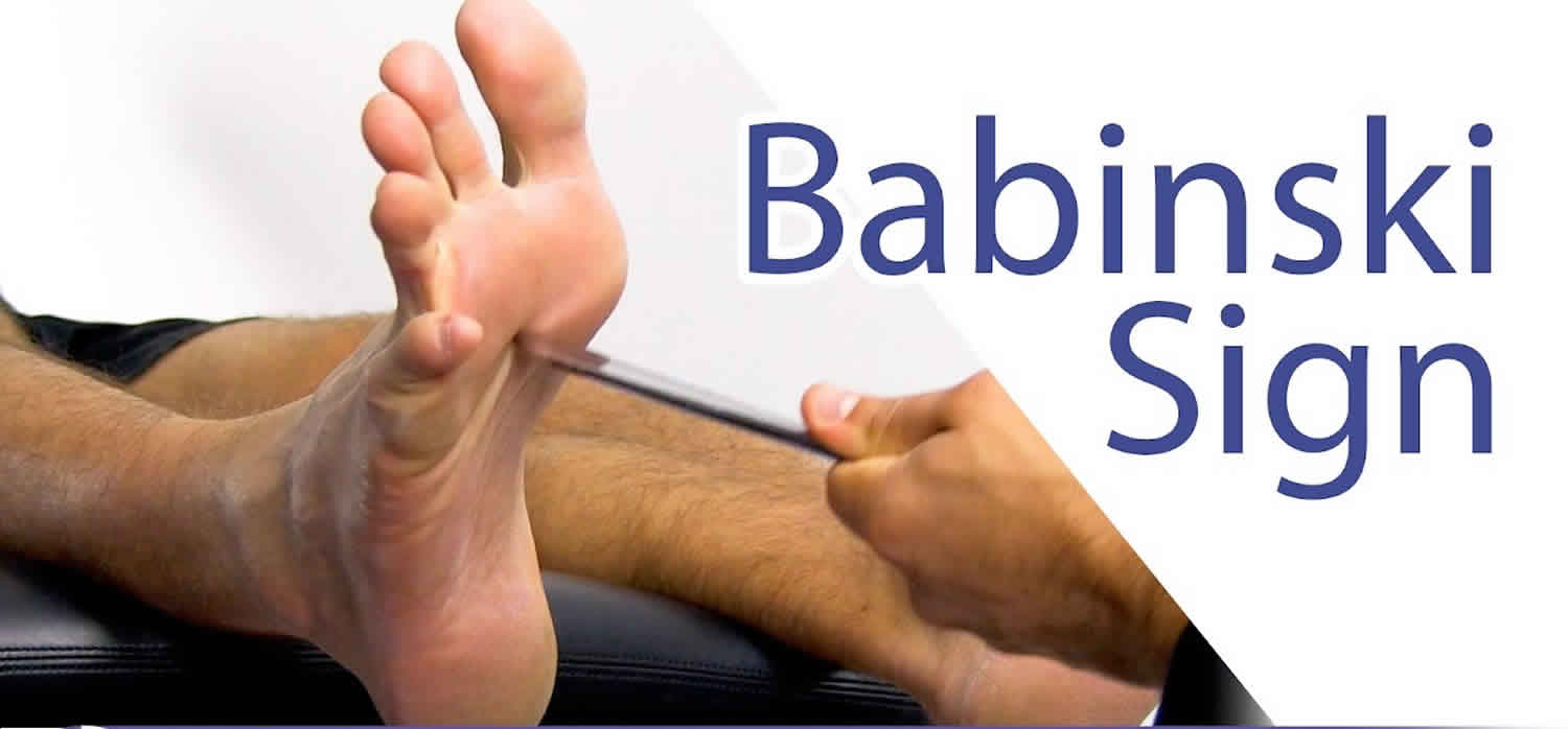 Babinski reflex test & causes of positive Babinski reflex in adults