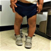 bow legged