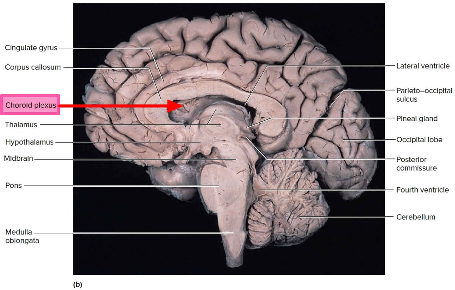 Choroid eye and choroid plexus function and choroid plexus tumors