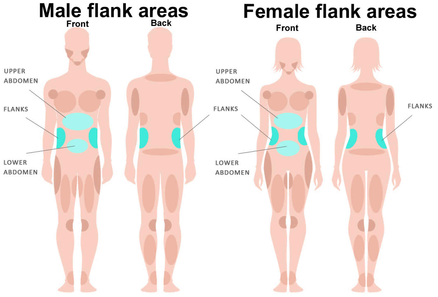 Other cause for acute flank pain