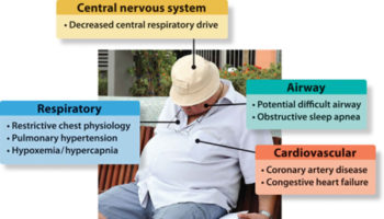 hypoventilation