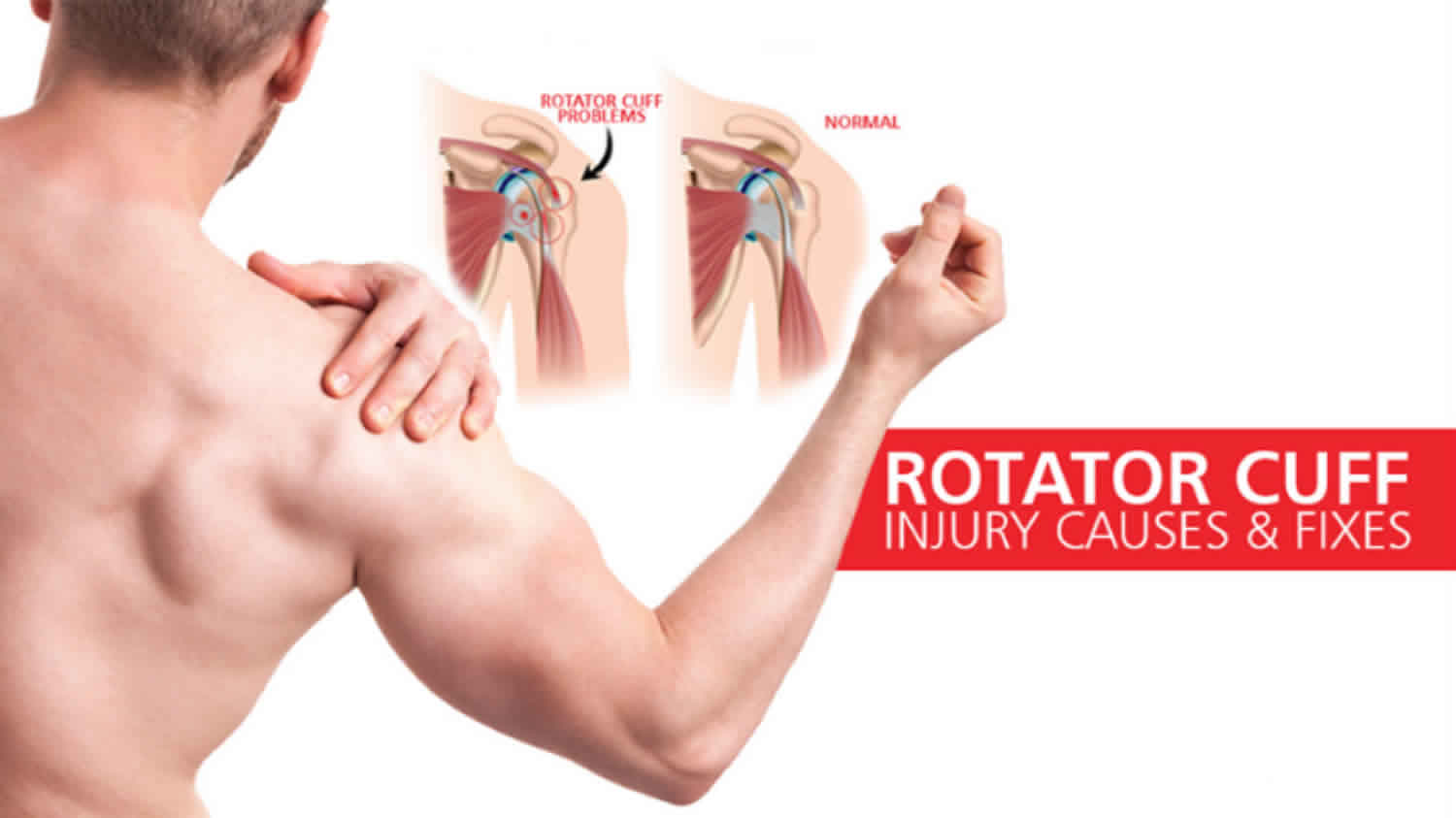 rotator-cuff-injury-causes-signs-symptoms-diagnosis-and-treatment