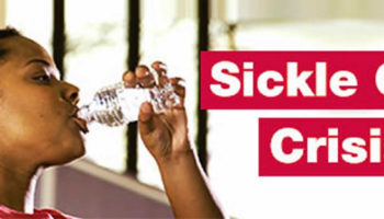 sickle cell crisis