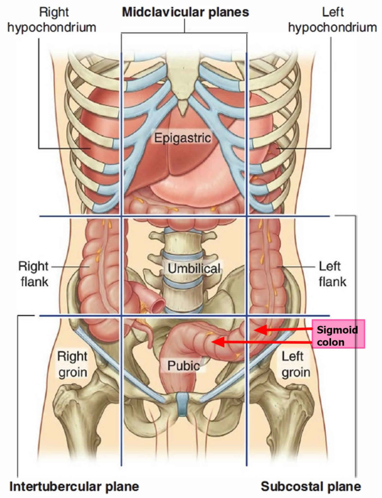 Sigmoid colon anatomy, location, function, polyps, diverticulosis & cancer