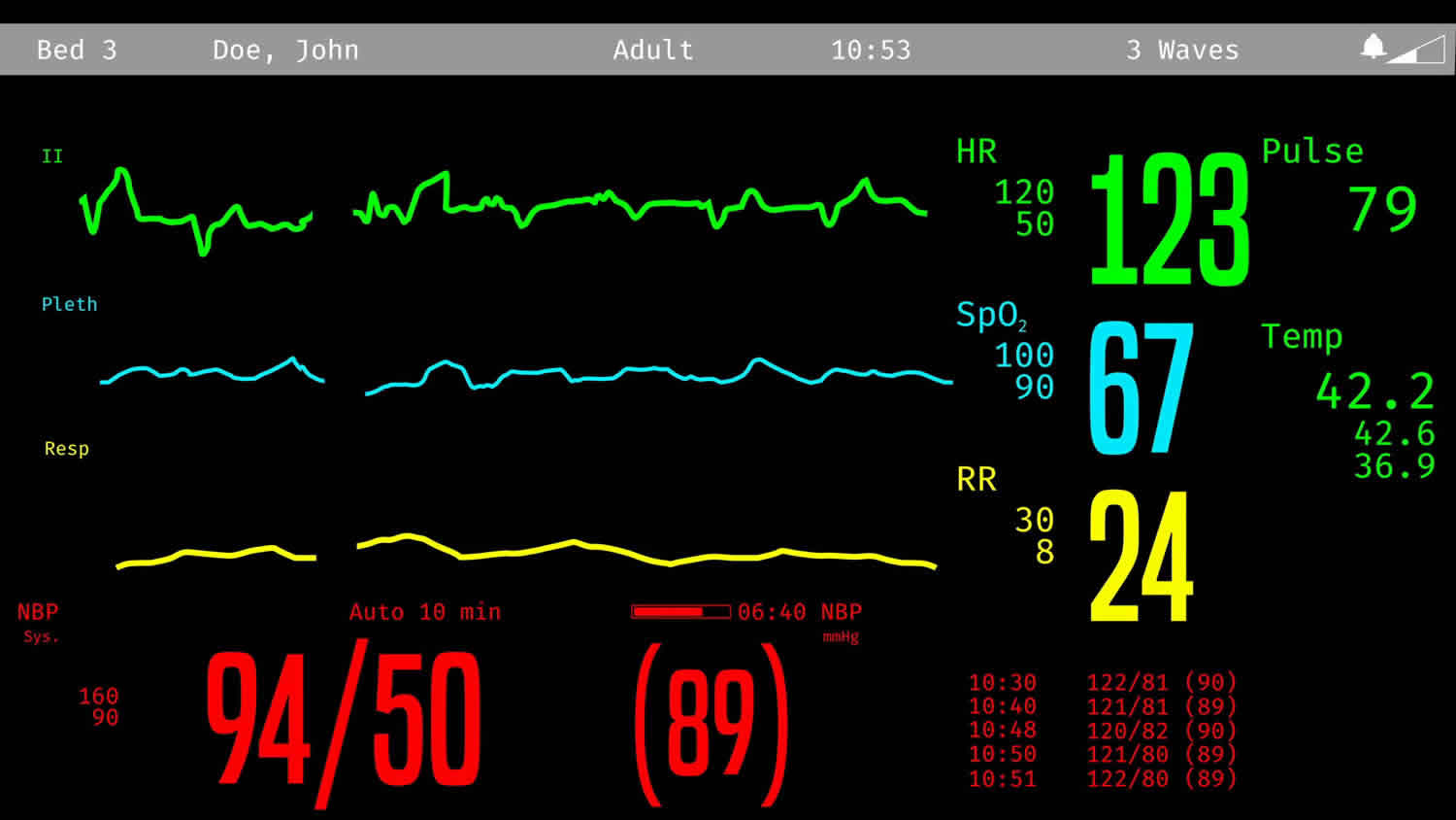 High heart rate low blood pressure information