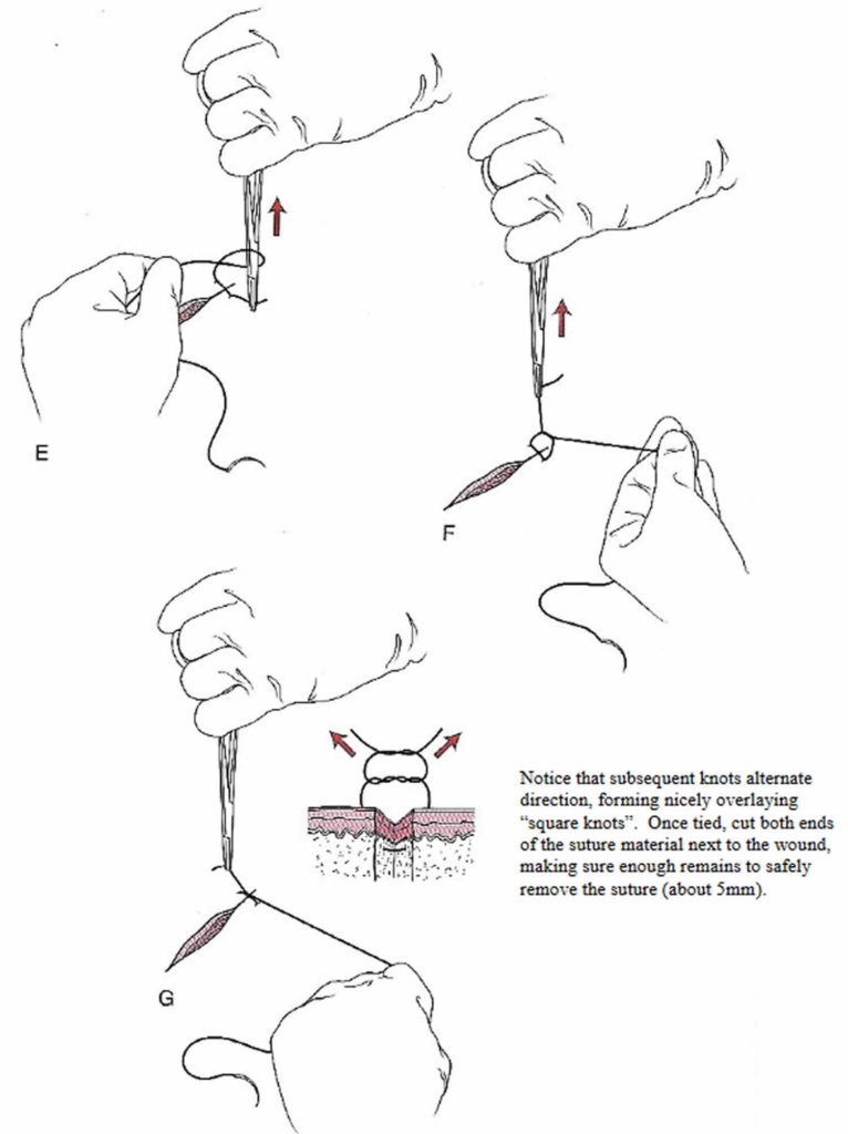 surgical-suture-types-of-sutures-sizes-how-to-suture-suture