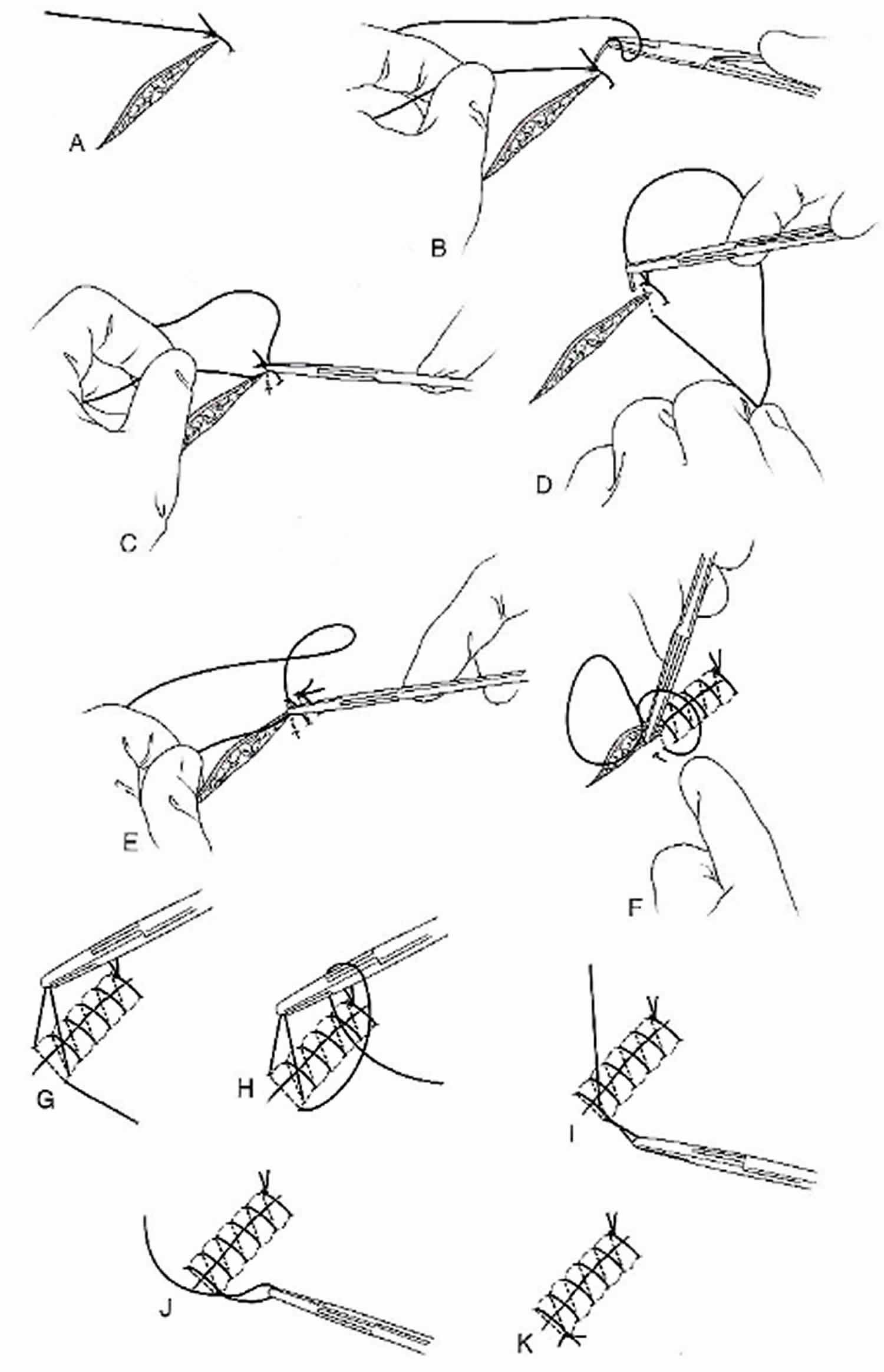 Simple running suture