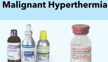 malignant hyperthermia