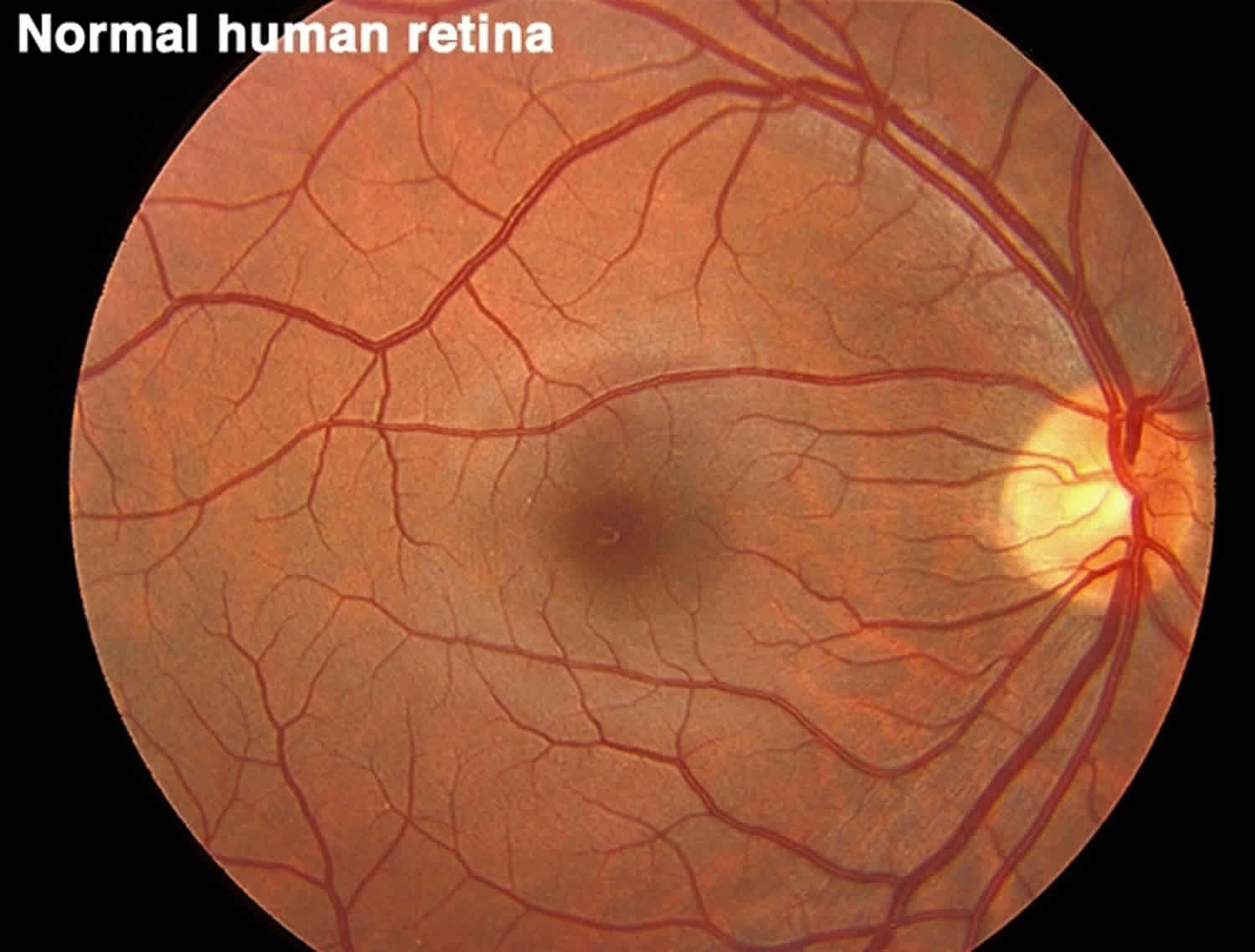 Normal human retina