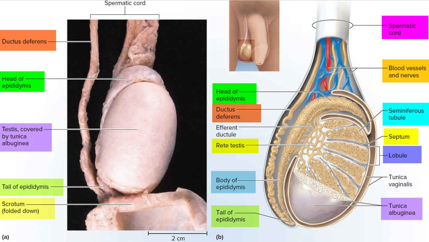 CRETO Scrotal Support use for vericocele and hydrocele helps in