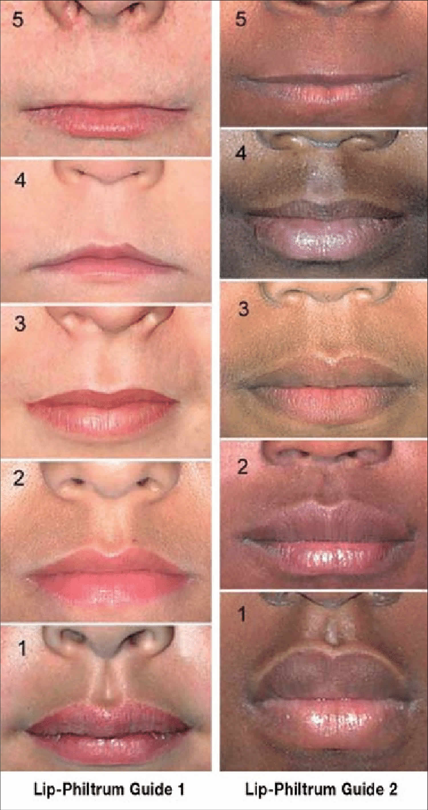 what is the purposes of the philtrum