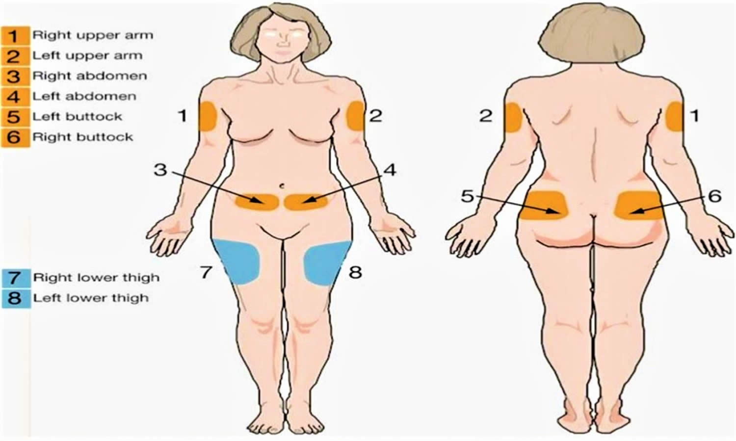 Subcutaneous injection sites
