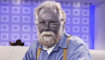 argyria