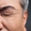 hyperalgesia
