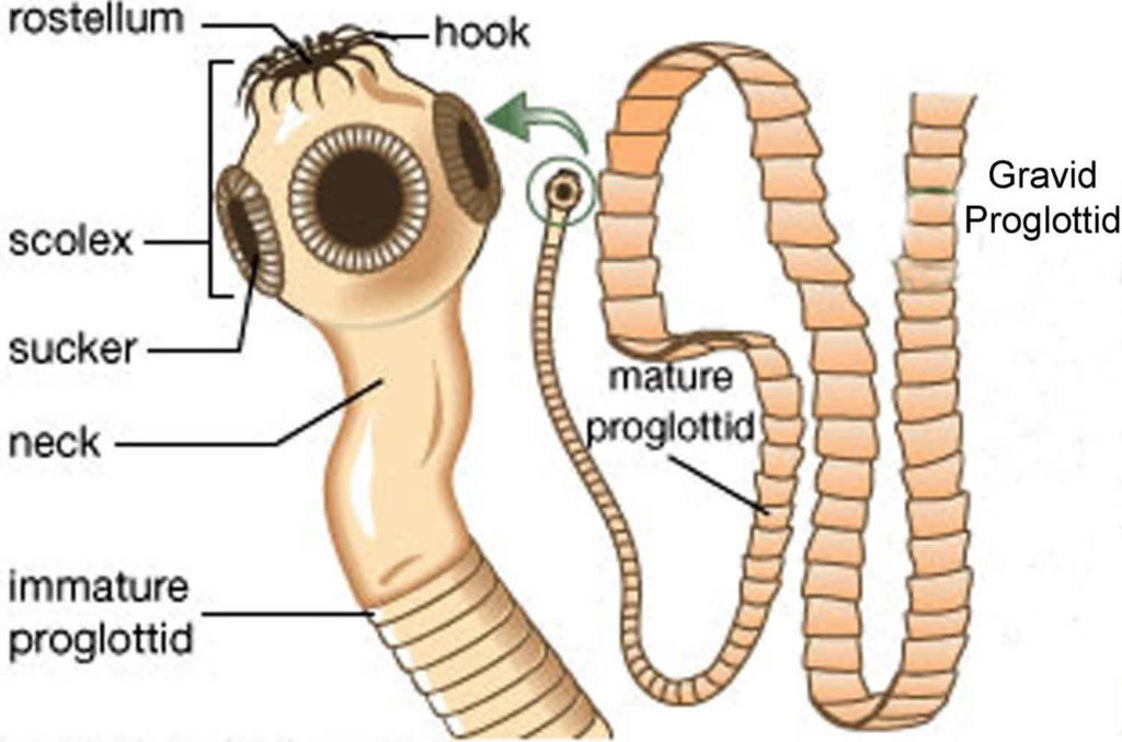 Cysticercosis Causes, Prevention, Symptoms, Diagnosis And Treatment