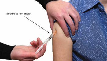 subcutaneous injection