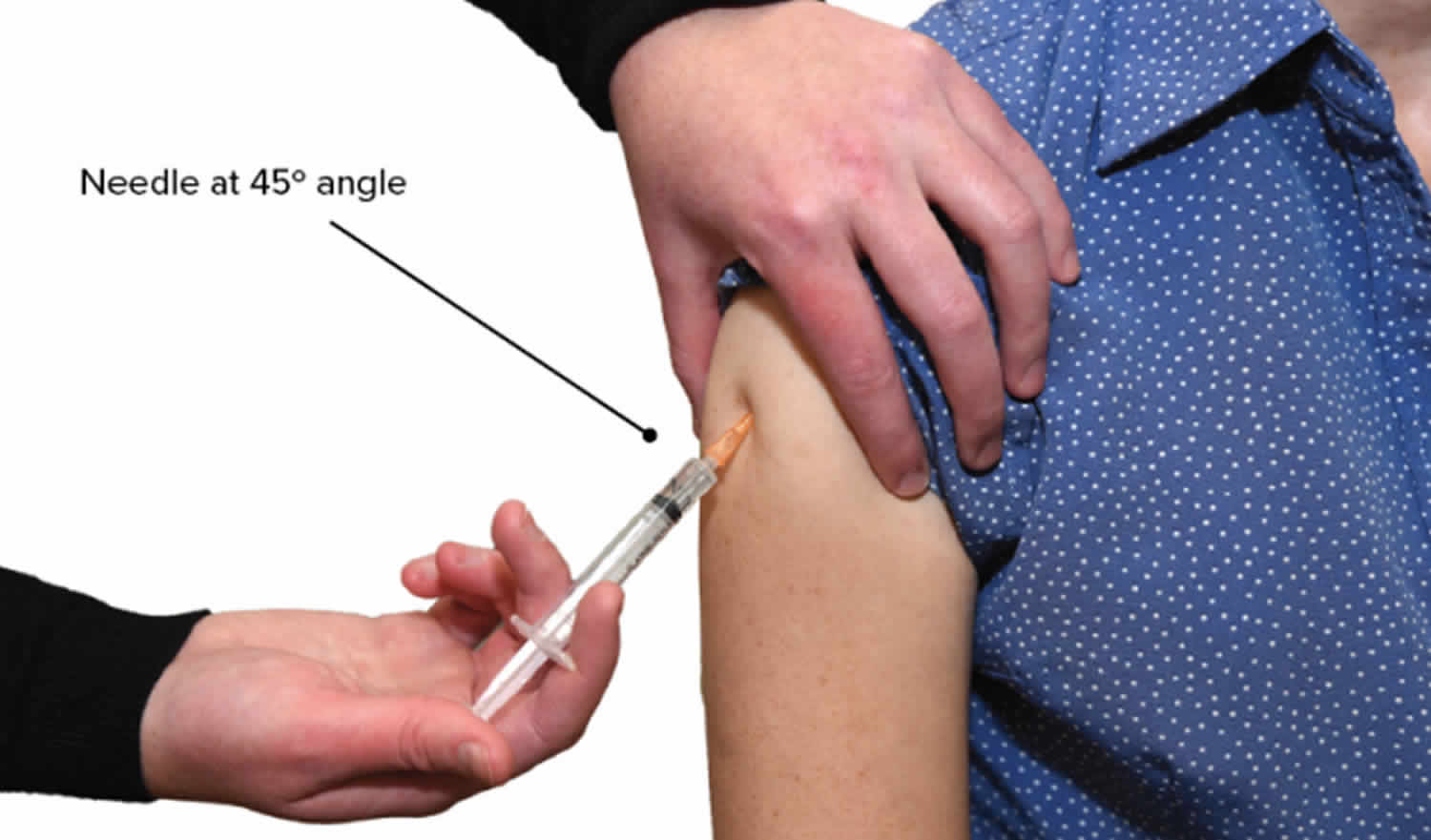 subcutaneous injection