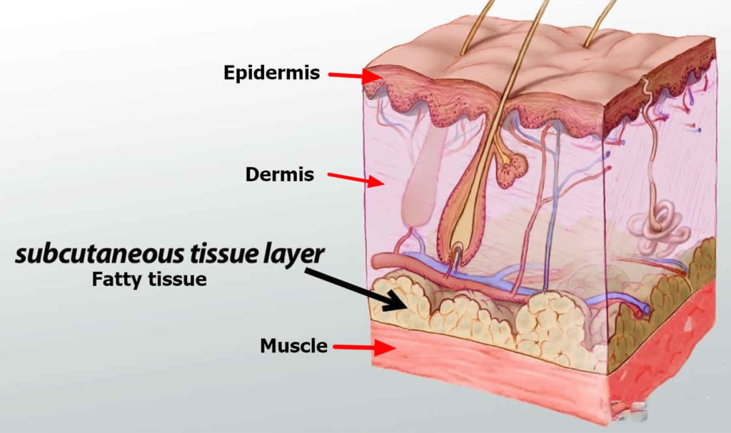 Subcutaneous injection sites, how to give subcutaneous injection ...