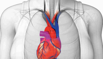 Dextrocardia