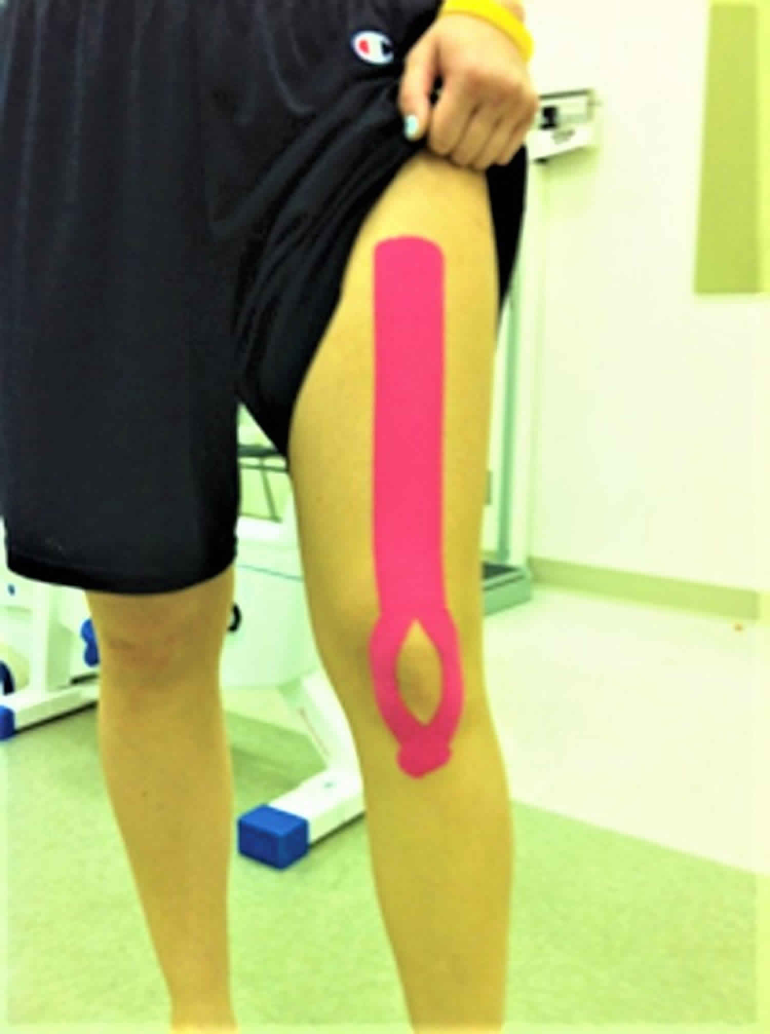 Kinesio tape for knee pain