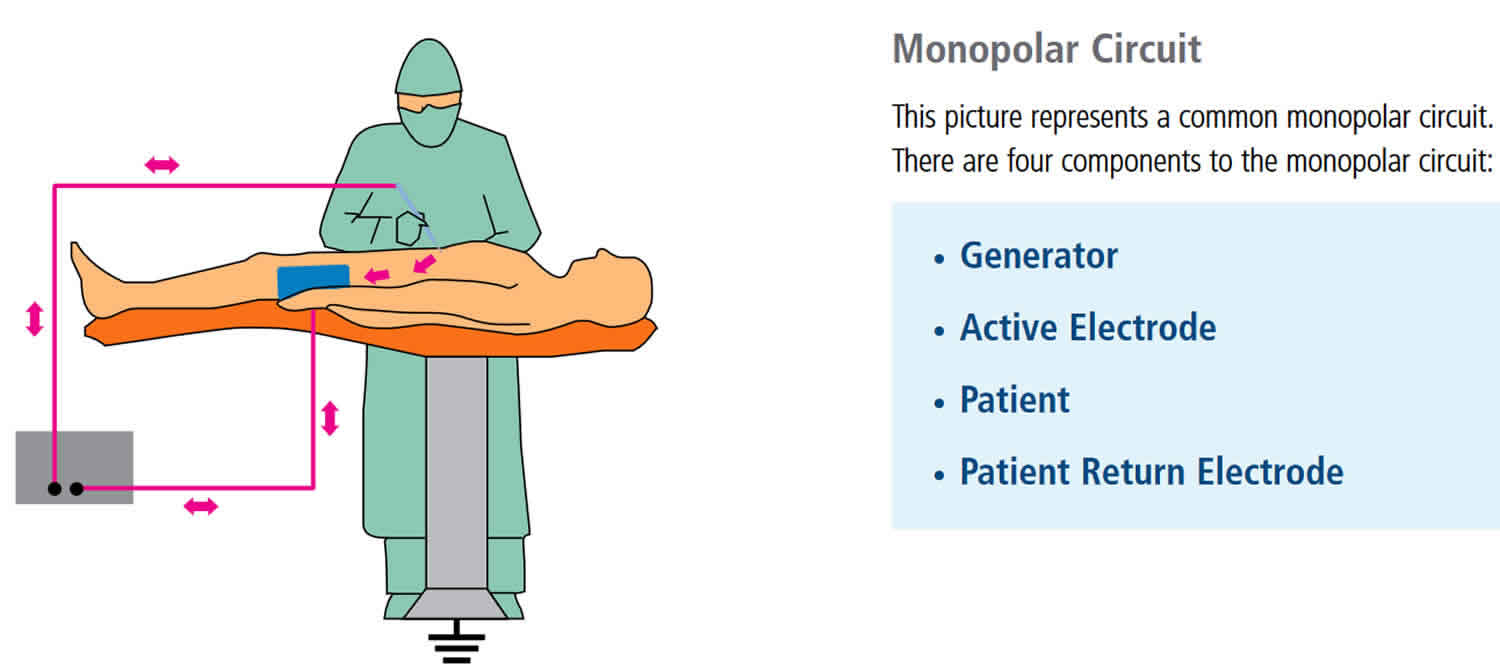 Monopolar electrosurgery