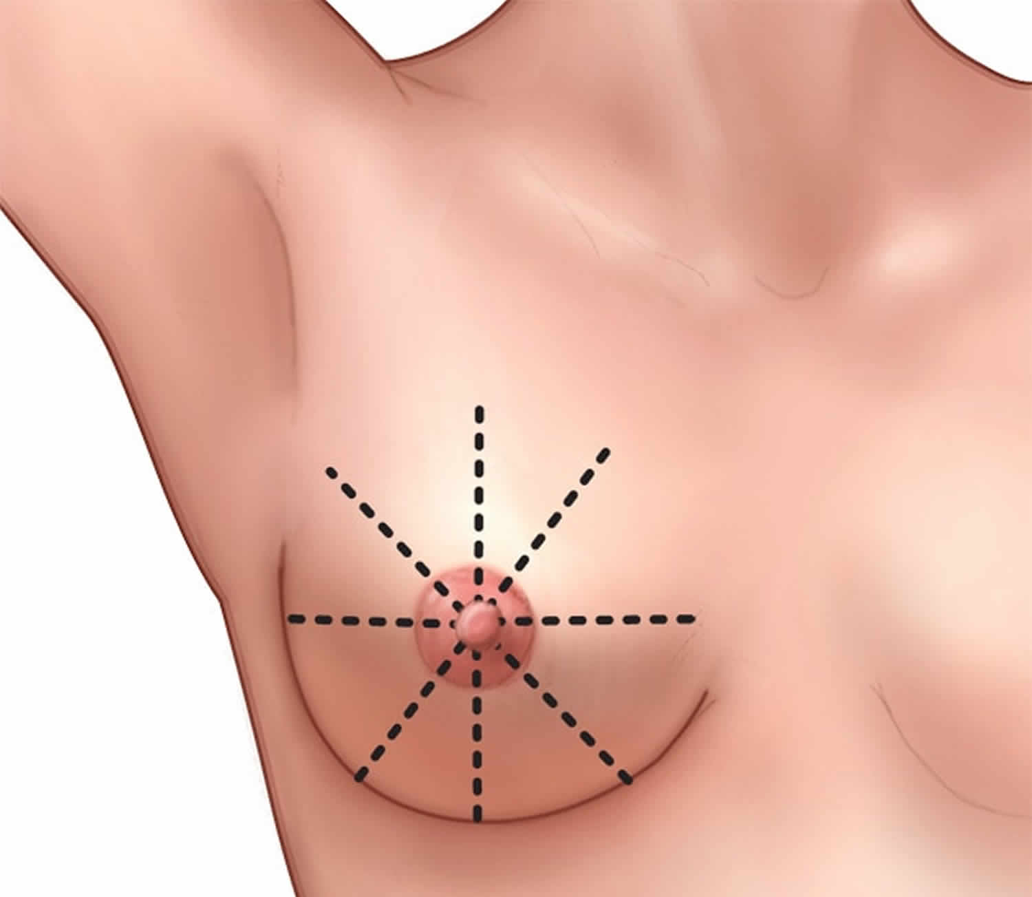 Self breast exam pattern