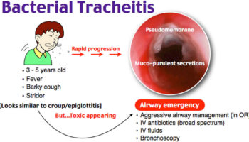 Tracheitis