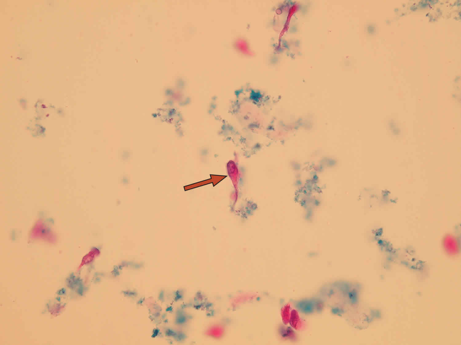 Epithelial Cells In Urine What Does It Mean If You Have Epithelial Cells In Urine 2219