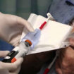 blood culture