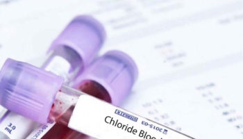 chloride blood test