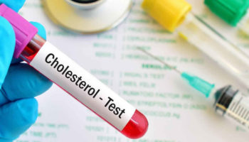 cholesterol test