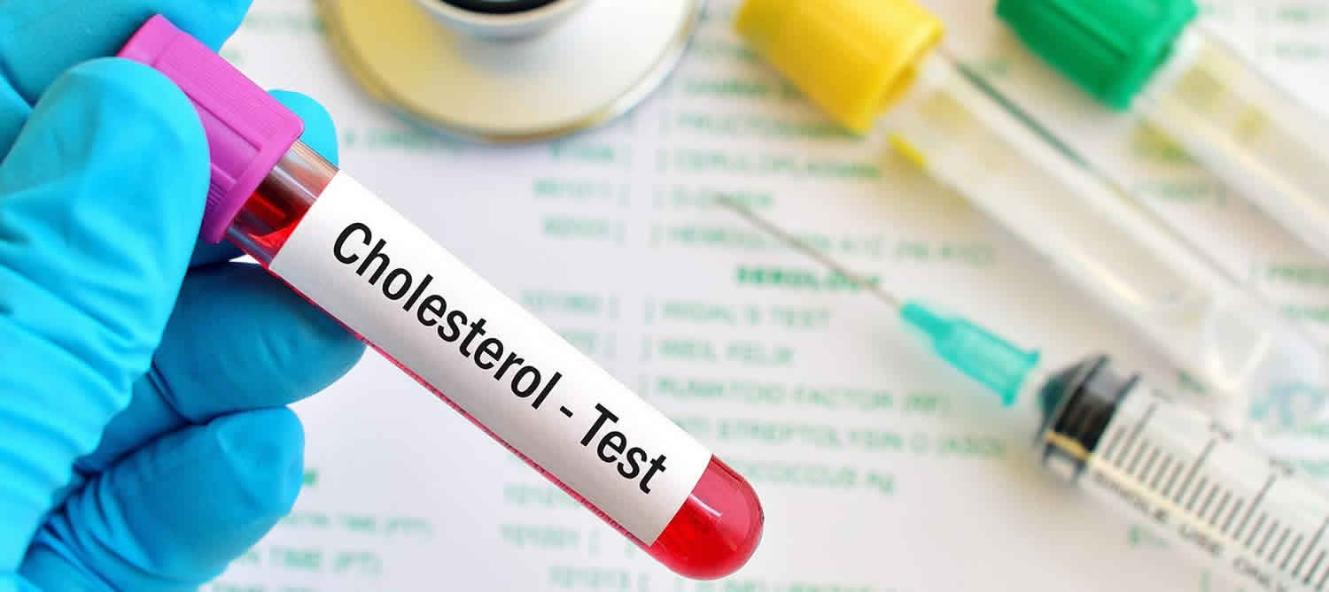 Normal Results For Cholesterol Test