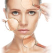 dermabrasion
