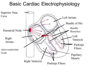 Cardiac Electrophysiology Study Procedure, Electrophysiology Test Of ...