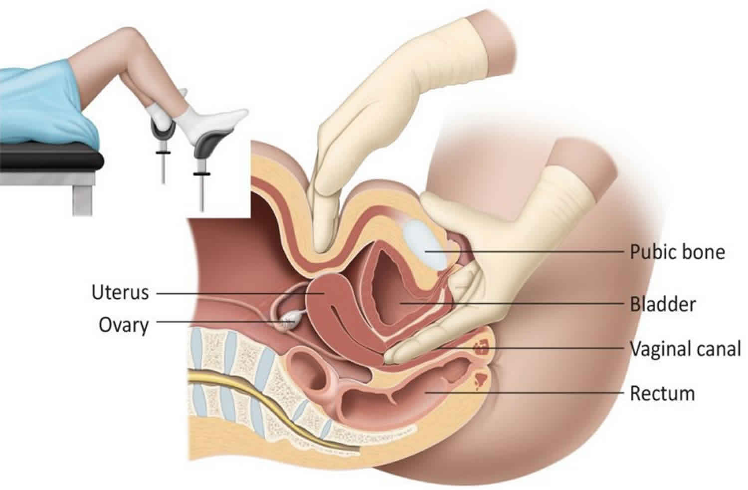 female pelvic exam