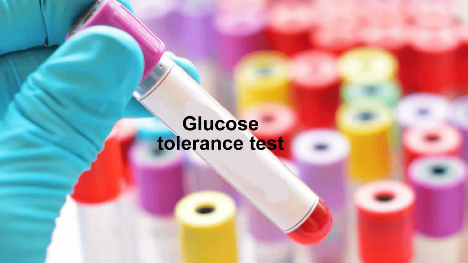 glucose-tolerance-test-oral-glucose-tolerance-test-prep-results